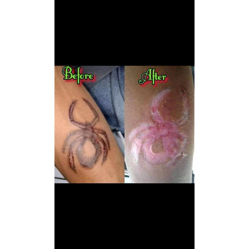 cairan penghapus tattoo /tatto remover