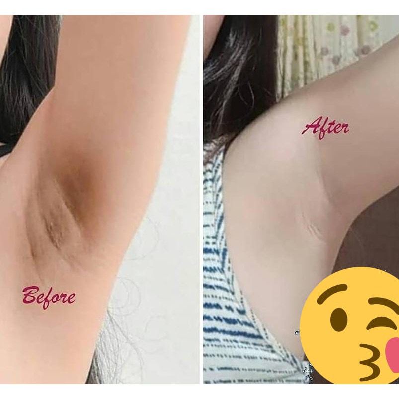 ✿ELYSABETHME✿ Cream ketiak kuntze bpom pemutih memutihkan anti daki wangi tahan lama