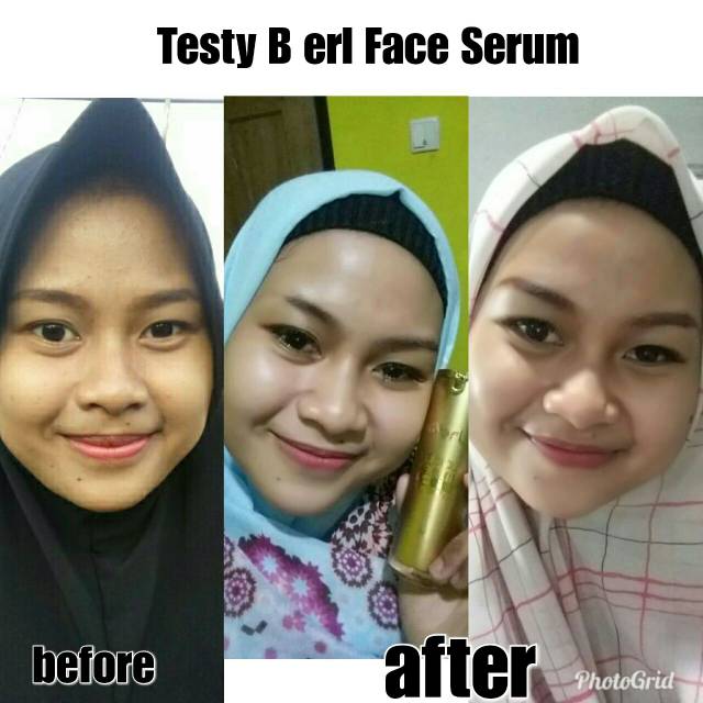 B ERL FACE SERUM ORIGINAL BY BERLCOSMETICS & SKINCARE