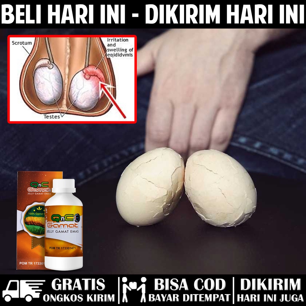 Jual Obat Buah Zakar Bengkak Varikokel Hernia Varises Pada Zakar