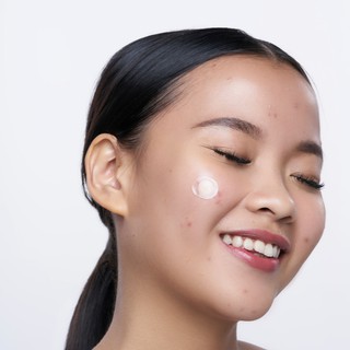 RUNA Acnedote Microneedle Technology Pimple Patch | Shopee Indonesia