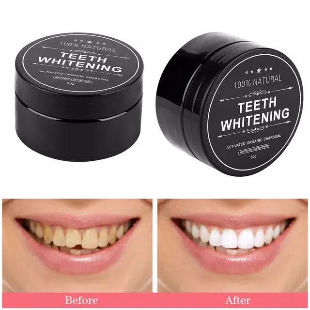 Pemutih Gigi Tercepat Ampuh (ASLI) Alami Natural Aman Bpom Odol Pasta Gigi Teeth Whitening Charcoal