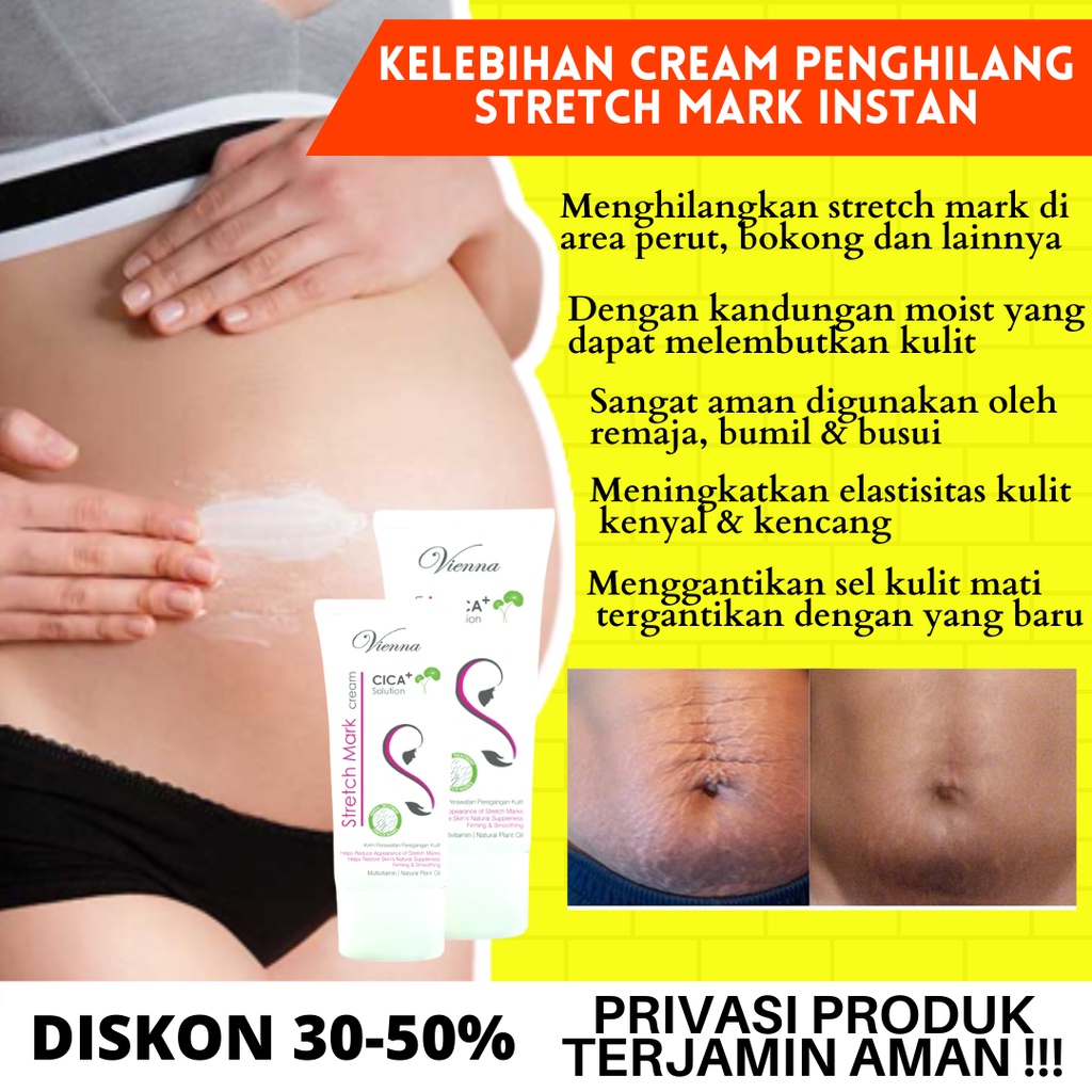 PENGHILANG STRETCH MARK IBU HAMIL PENGENCANG KULIT VIENNA STRETCHMARK CREAM 80ML PENCERAH KULIT CREAM PERAWATAN KULIT ORIGINAL BPOM