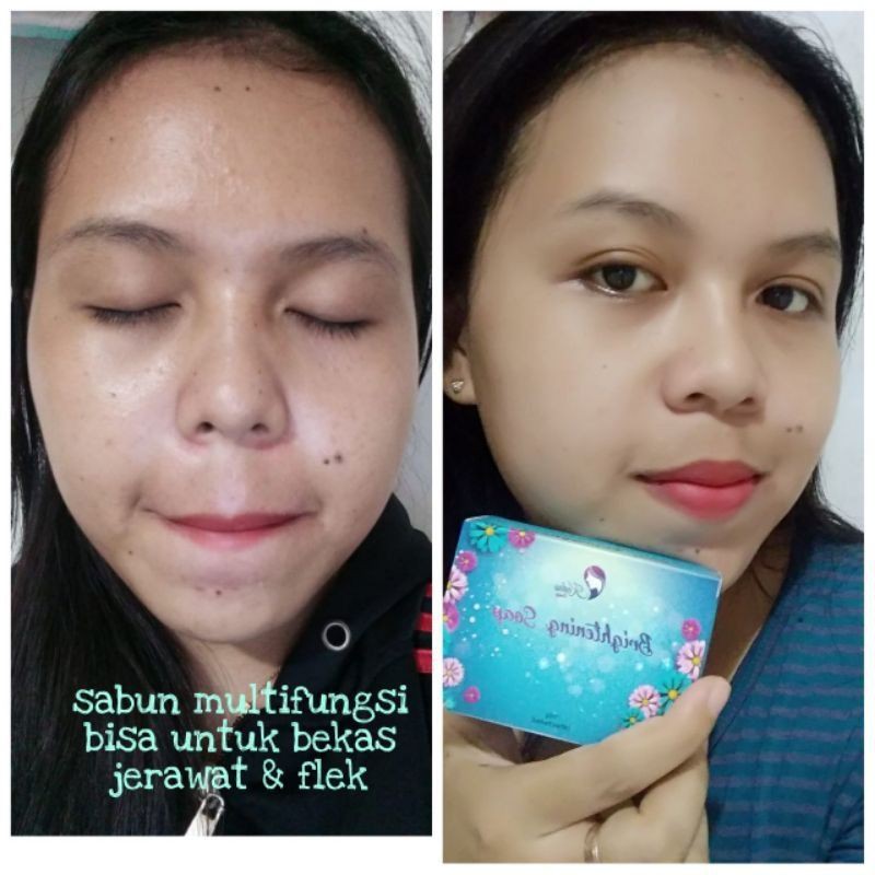 [BISA COD] SABUN KEDAS BEAUTY ORIGINAL BPOM | Kedas Beauty | Sabun Pemutih Wajah-5