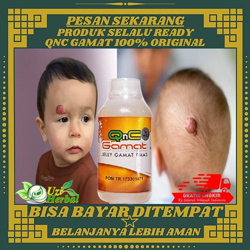 Obat Herbal Penghilang Hemangioma, Hemangioma Pada Bayi, Benjolan Di Kulit Kepala, Wajah, Punggung