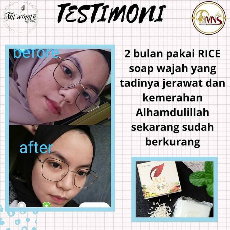 Rice Soap SR12 Sabun Beras Face Wash Sabun Pencerah Alami Saber