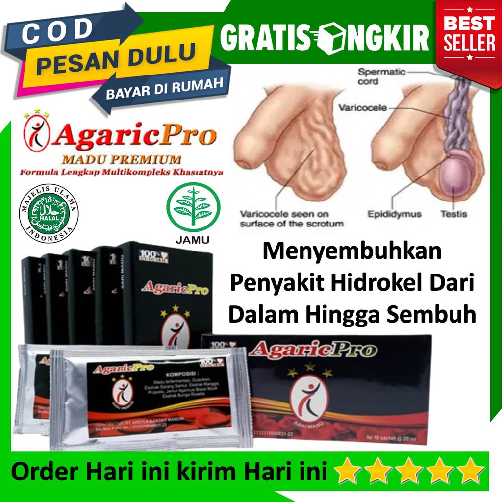 Obat Herbal Biji Zakar Bengkak, Pembengkakan Buah Zakar, Pembengkakan Testis, Pembengkakan Bijipelir