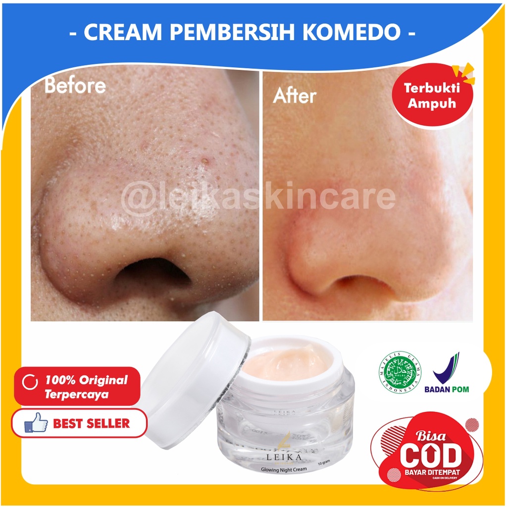 Krim Komedo Dan Pori Pori Krim Komedo Ampuh Penghilang Komedo Hidung Dan Pori Pori Penghilang Komedo