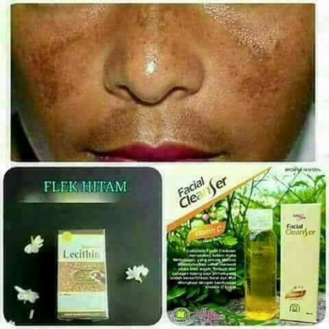 PENGHILANG FLEK HITAM OBAT FLEK HITAM - LECITHIN - COLLASKIN FACIAL CLEANSER COFC ASLI NASA
