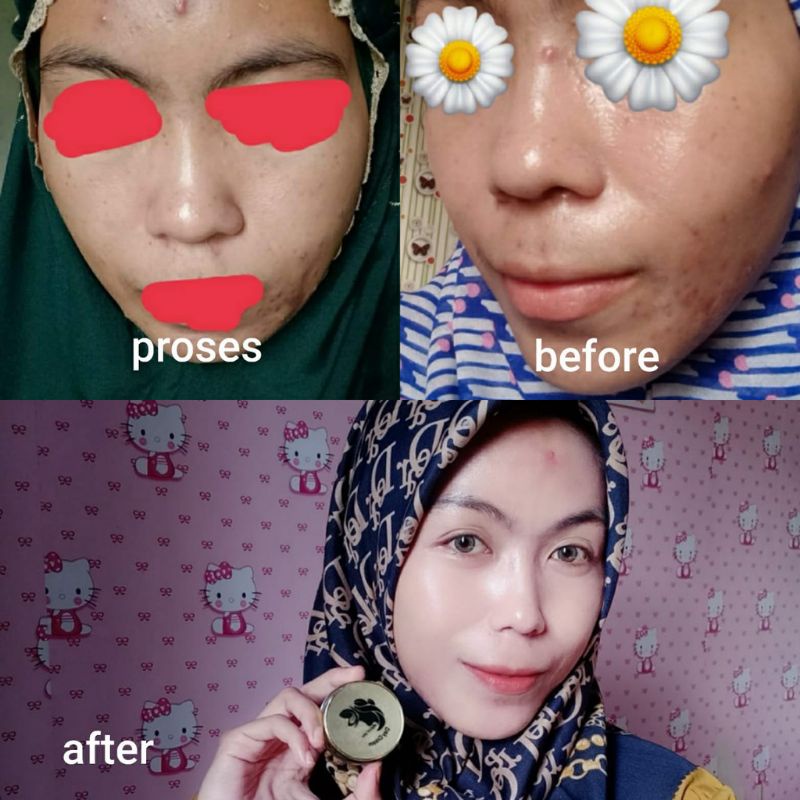 MRASKIN GLOW PAKET SKINCARE WAJAH BPOM ORIGINAL