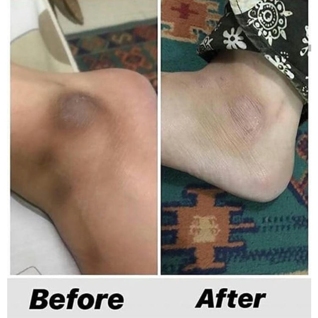 CREAM PEMUTIH LEHER KETIAK SELANGKANGAN BPOM 100 AMPUH CREAM LEHER ORIGINAL BPOM