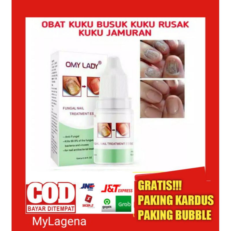OBAT KUKU JAMURAN CANTENGAN AMPUH KUKU RAPUH