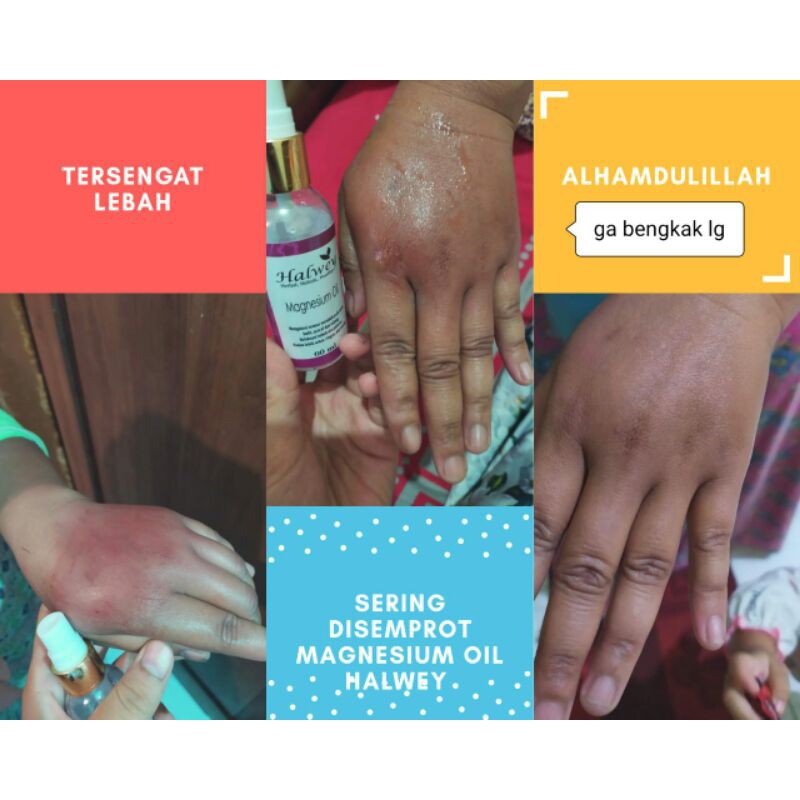 Magnesium Oil