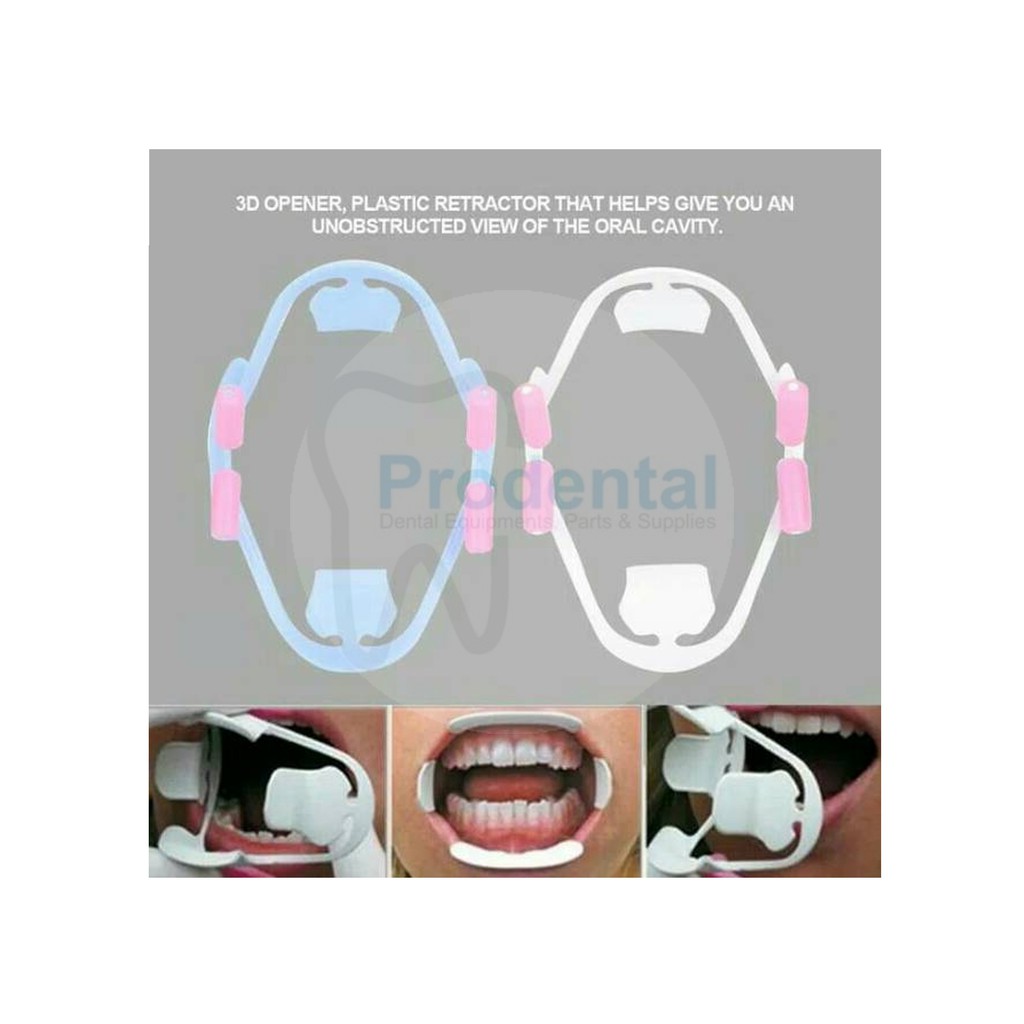 Oral Opener Cheek Retractor / Mouthgate Mouth Gag 3D