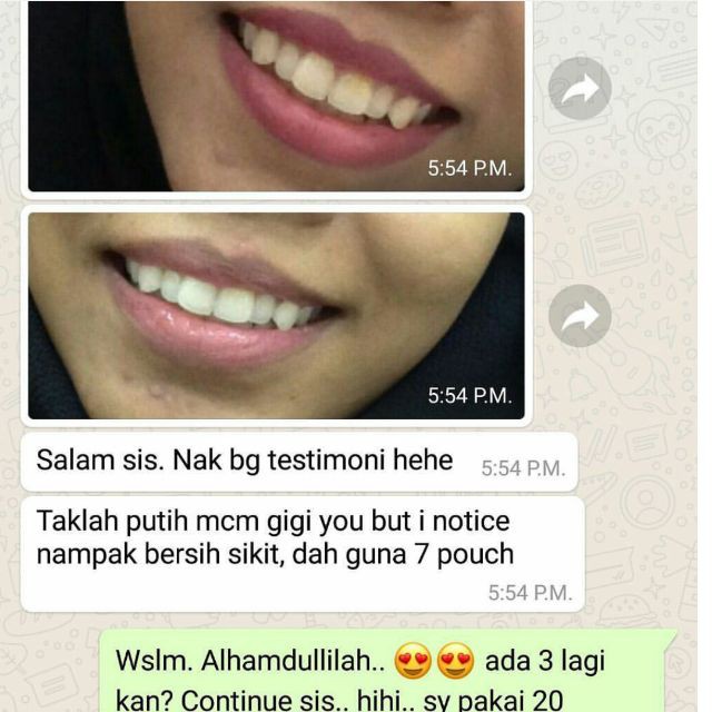 Pemutih Gigi Alami ORIGINAL Teeth Whitening Charcoal Powder Arang Bubuk Senyum Cantik