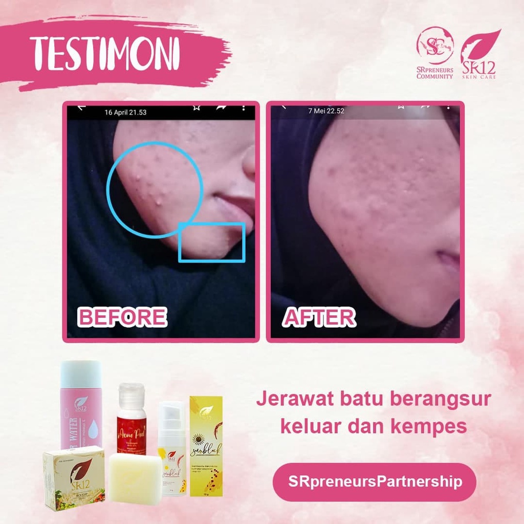 SABUN BERAS HERBAL SR12 RICE SOAP / SABUN JERAWAT BPOM / KULIT BERMINYAK &amp; SENSITIF