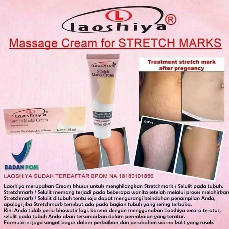 Cream Penghilang Anti Stretchmark Kulit Perut Ampuh Selulit Guratan bpom Stretch Mark Laoshiya