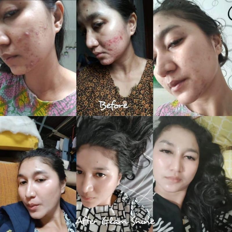 GLAMSHINE/ GLAMSHINE PAKET WAJAH/ GLAMSHINE GOLD SERIES ( NEW PACKAGING )-2