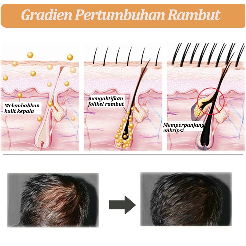 shampo rambut rontok shampo anti rontok Sampo jahe 400ml Anti-hair loss anti ketombe Kontrol Minyak pertumbuhan rambut