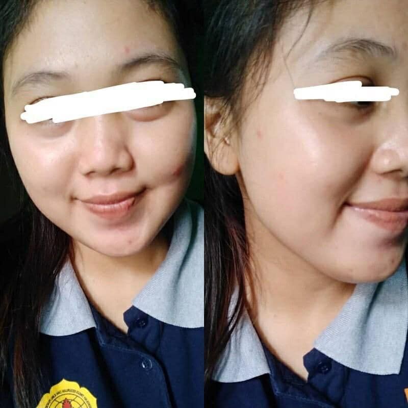 Cream Pemutih wajah/Paket Glow normal/cream dwf