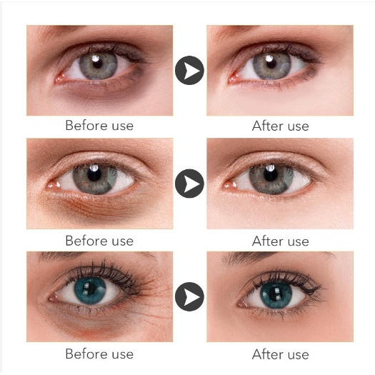 【ORIGINAL】Krim Mata Eye Cream Polypeptide Elastic Repair Eye Cream Krim mata lingkaran hitam 30g Remove Eye Pattern/ Eye Bags /Fat-Free Granules / Fade Dark circles / Moisturizing bpom