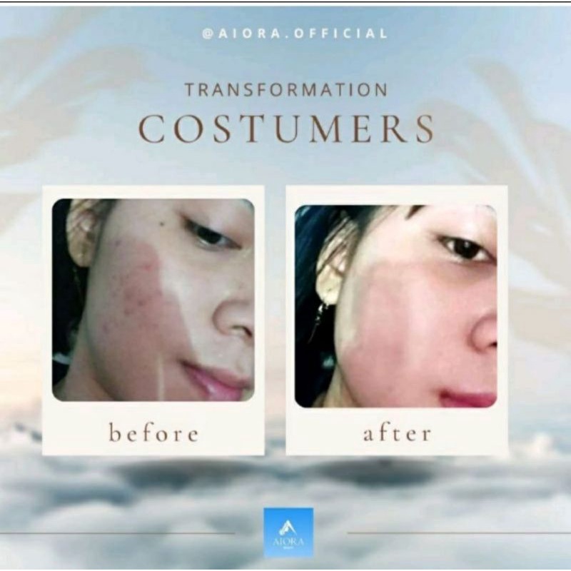 AIORA skincare by aditya amarzoni skincare artis