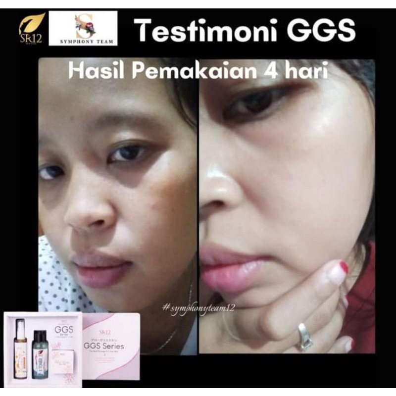 GGS SERIES GLOW GLASS SKIN SR12 HERBAL SKINCARE BPOM - KRIM GLOWING DALAM 1 MINGGU MENGHILANGKAN FLEK JERAWAT KRIM GLOWING KOREA PEMUTIH CEPAT ALAMI AMAN BPOM SKINCARE