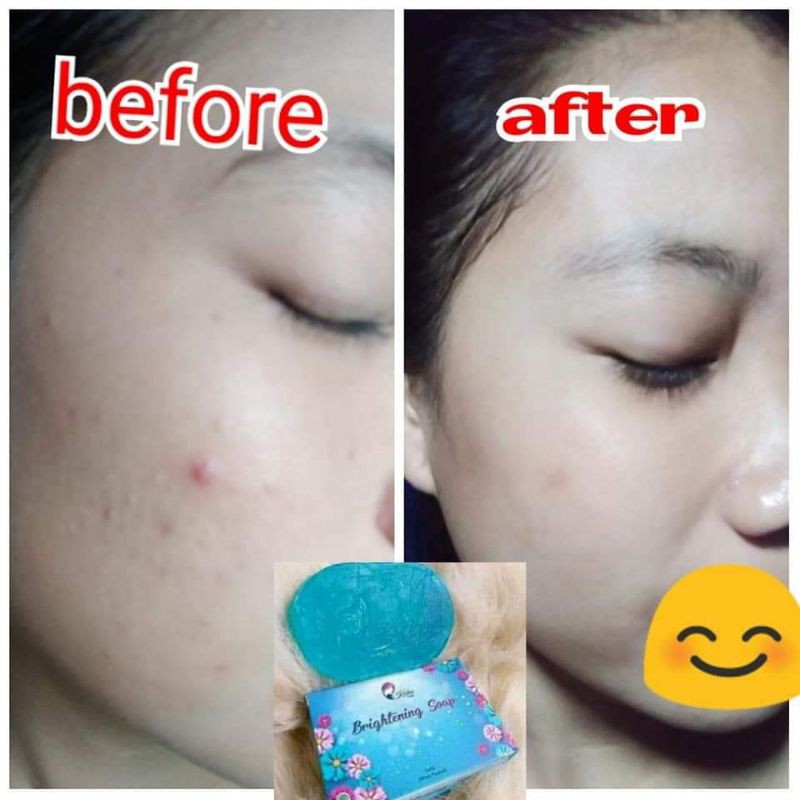 KEDAS BEAUTY SEPAKET BODY SCRUB KEDAS BEAUTY BODY SERUM SABUN PEMUTIH BADAN DAN WAJAH KEDAS BEUTY-5