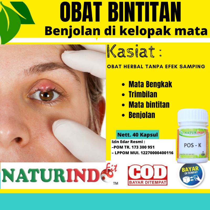 Obat Bintitan Herbal Ampuh Trimbilan Bengkak Di Kelopak Mata Benjolan Mata Bengkak