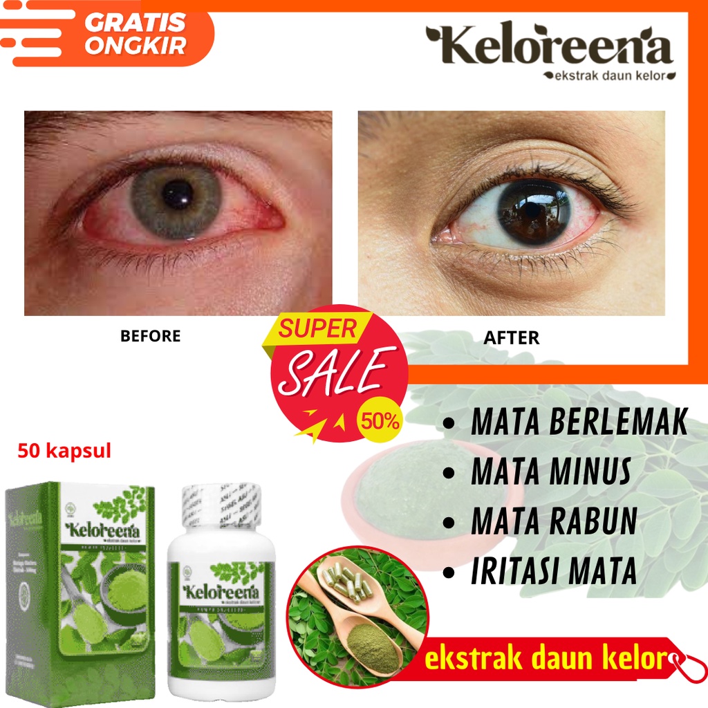 Memutihkan Bola Mata Pucat - Obat Tetes Mata Merah dan Kuning - Kelorena Obat Kapsul Mata - Vitamin 