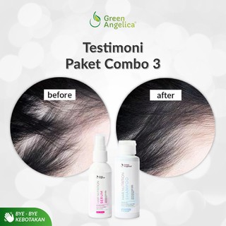 Shampo Dan Serum Green Angelica Untuk Mencegah Kebotakan Shampo Dan Serum Green Angelica Untuk Mencegah Kebotakan