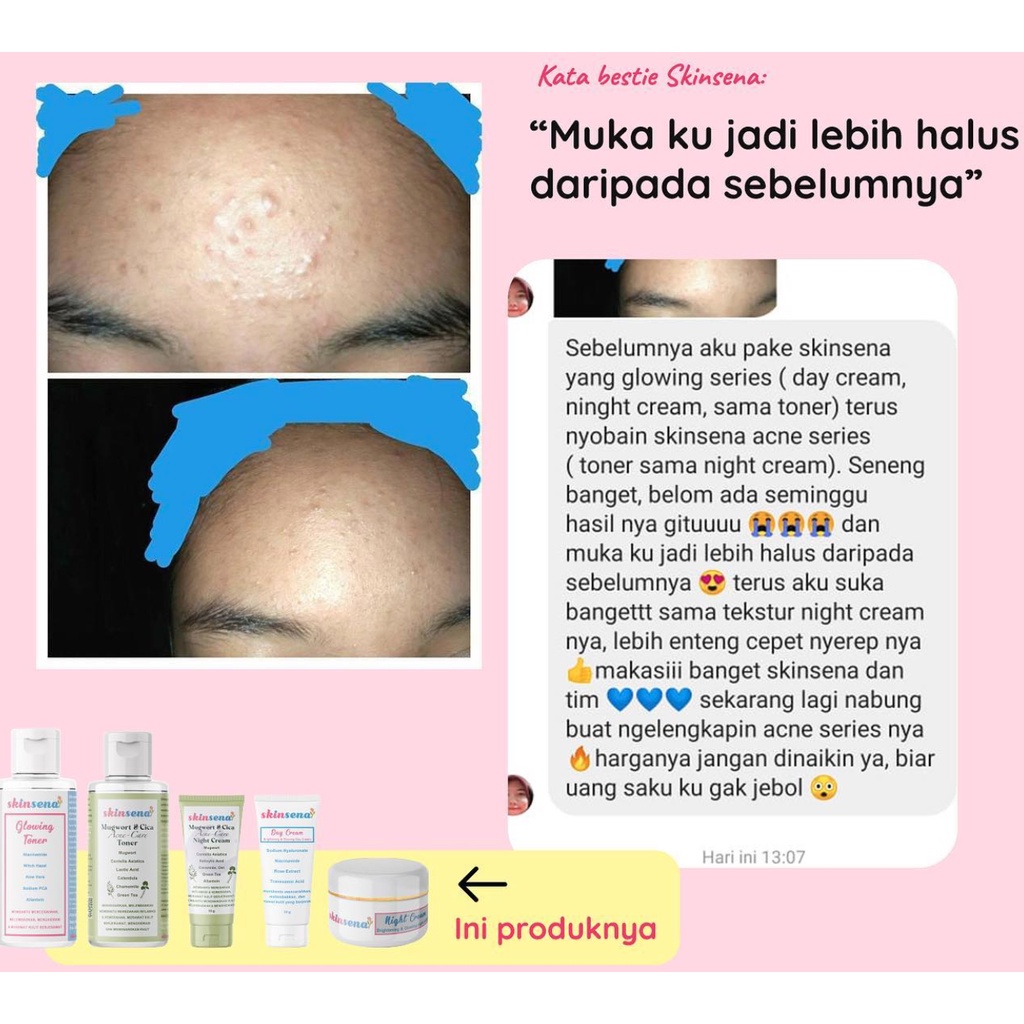 SKINSENA glowing mugwort cica acne care/toner / day / facial face wash cleanser / essence / serum / night cream / acne spot gel / mask masker / body lotion / body scrub mini size full size glow murah bpom mencerahkan jerawat acne prone bruntusan skin sena