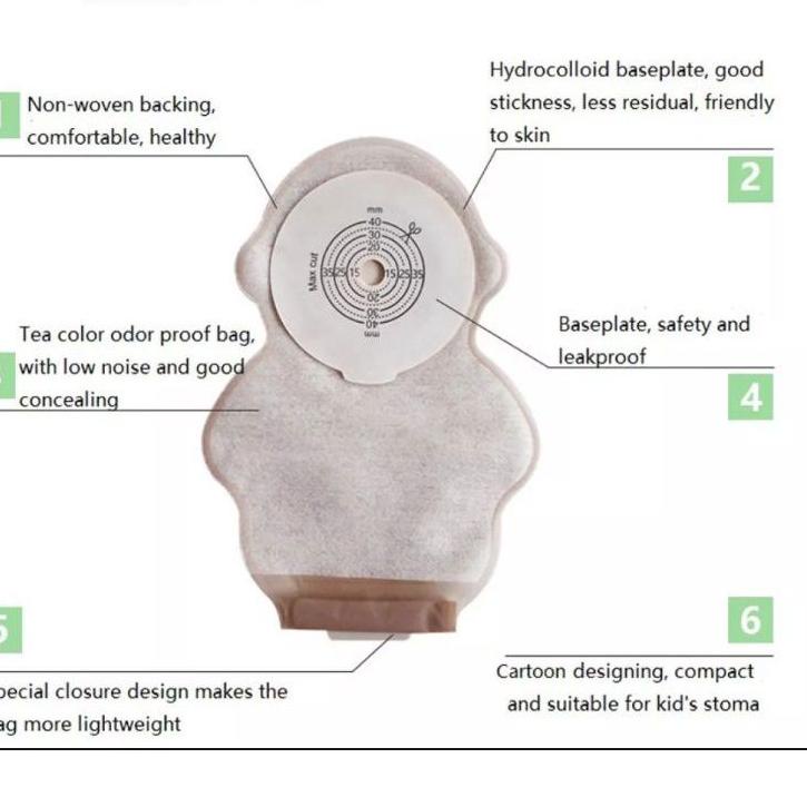 Terbaru.. colostomy bag newborn / stoma bag bayi