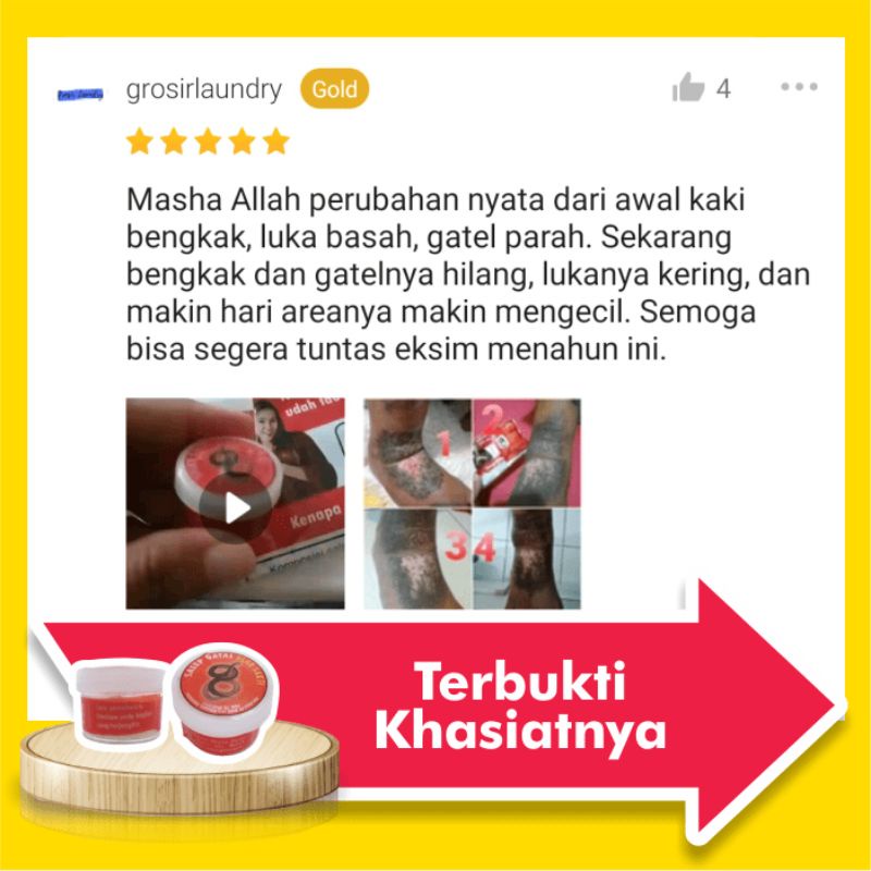 Obat Salep Gatal Eksim Kering Menahun Paling Ampuh Kulit Gatel Basah Selangkangan Kurap Kutu Air Luka Diabetes Panu Kudis Kadas-6