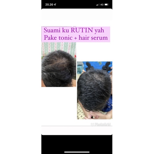 SISSEY SERUM HAIR GROWTH ( beli 4 mixed sissey free gift )