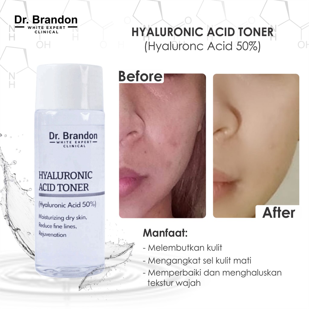 Dr Brandon Hyaluronic Acid Toner With Hyaluronic Acid 50 Shopee Indonesia