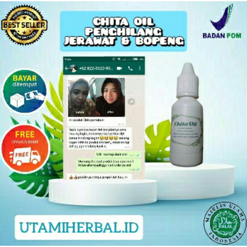 PENGHILANG JERAWAT & BOPENG