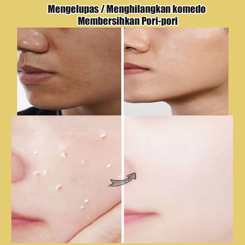 Body Scrub Peel Wajah Facial Glowing Blackhead Cleaner Peeling Gel Facial Scrub Body Exfoliating Mengangkat Sel Kulit Mati Peeling Mencerahkan Kulit Shower Scrub Pengelupasan Kulit Peel Tubuh Scrub