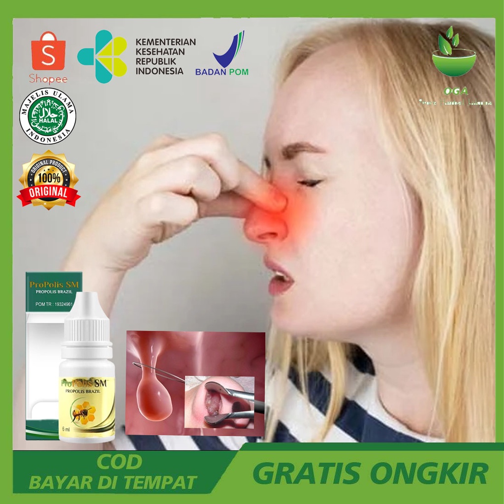 Propolis SM Obat Sinusitis Tetes Diteteskan ke hidung tersumbat Sinus Hidung Flu Pilek Menahun Tersu