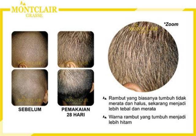 ORIGINAL/Montclair Hair Serum/Penumbuh Rambut Bergaransi-5