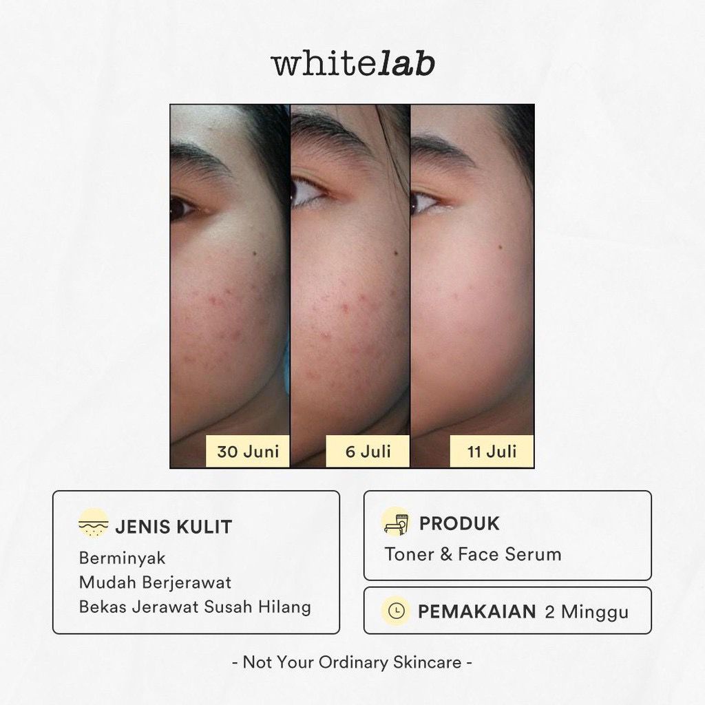 Whitelab Brightening Face Toner Wajah