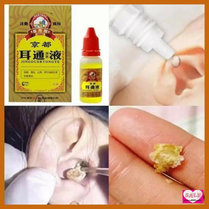 KUPIANGTALINGO- OBAT TETES TELINGA HERBAL CINA UNTUK TULI OTITIS TINNITUS -ASLIII.