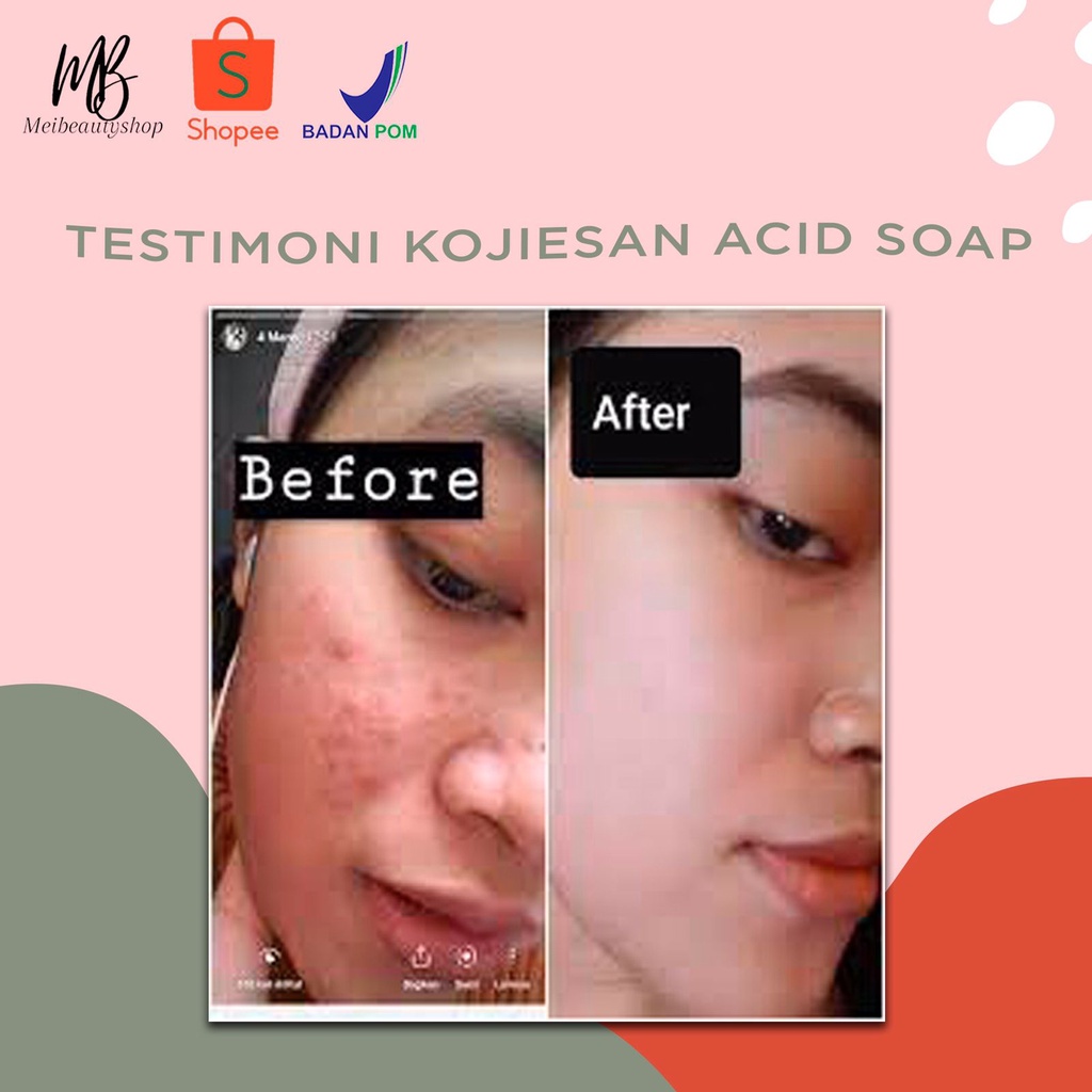 KOJIE SAN Skin Lightening Soap / Kojiesan Soap / Sabun Pemutih