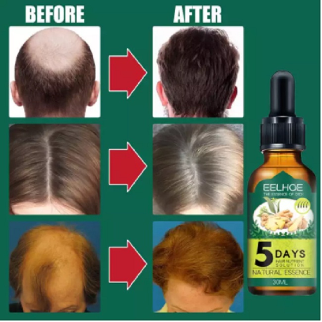 Penumbuh dan Penebal Rambut Rontok 5 Day 30ml