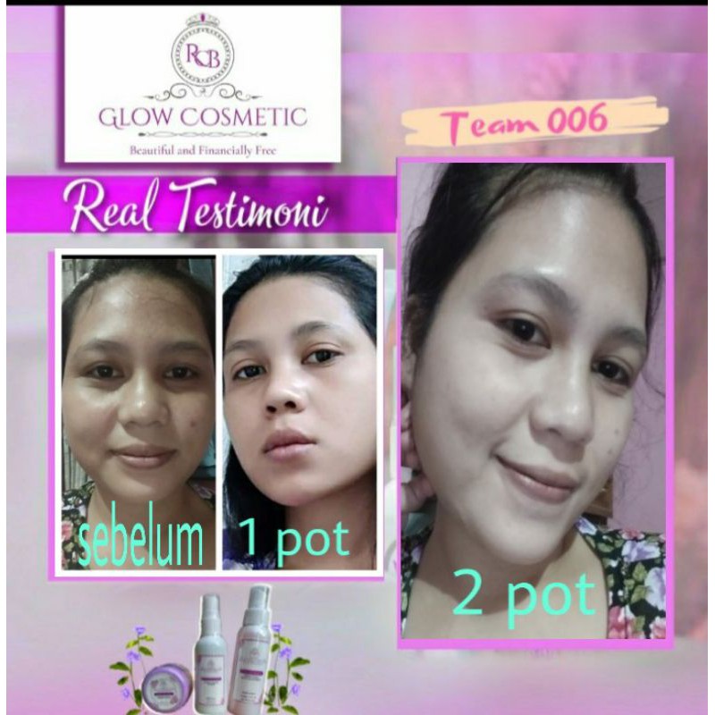 CREAM RCB GLOW ORIGINAL ( KEMASAN BARU) BPOM/WHITENING GLOWING CREAM/CREAM ALL IN 1/ RCB GLOW COSMETIC