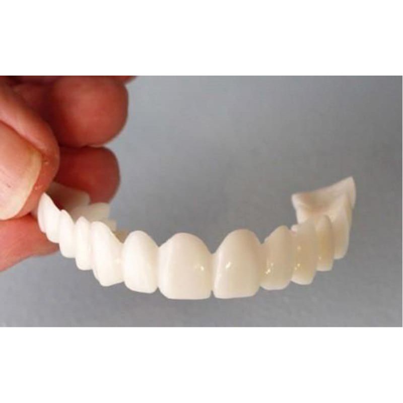 snap on smile satuan atas/bawah