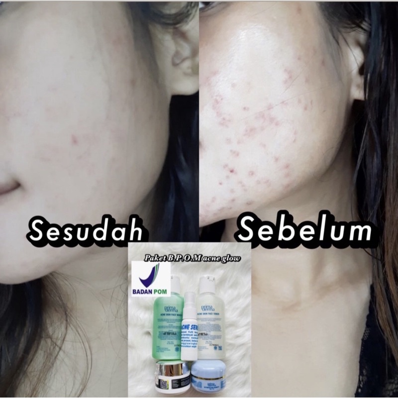 Primaderma Bpom Original