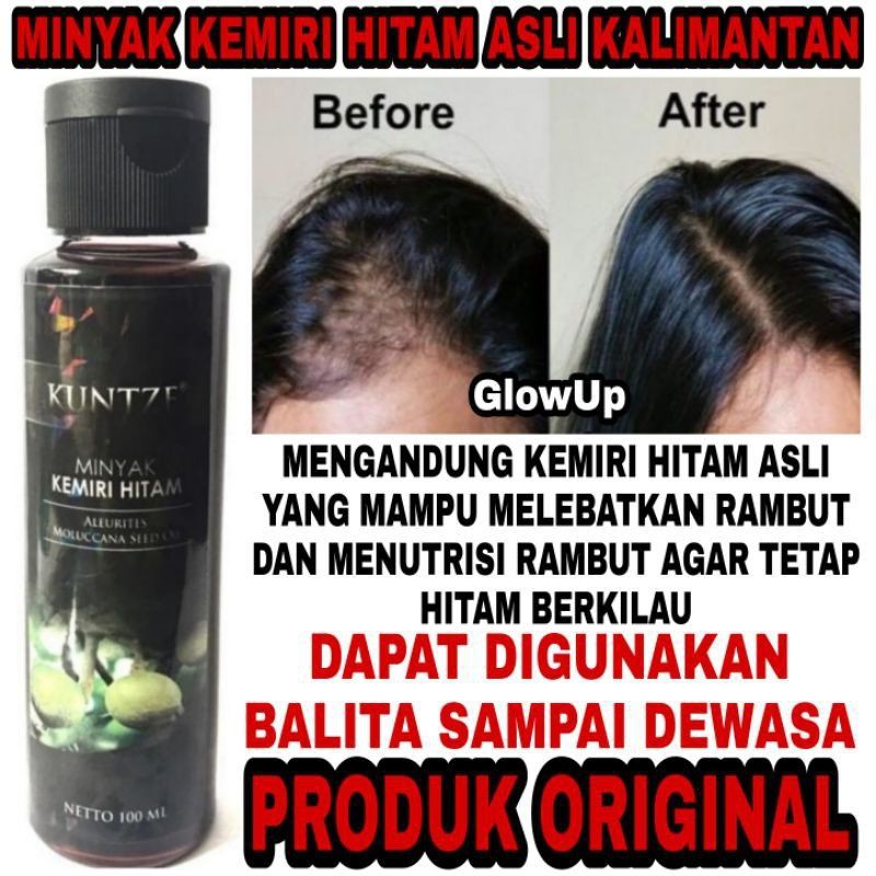 KUNTZE MINYAK KEMIRI HITAM ORIGINAL BPOM 100ML - MINYAK KEMIRI KUNTZE