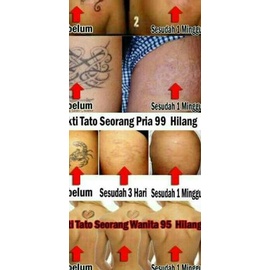 ☎ TATTONOX / TATONOX - PENGHAPUS PENGHILANG TATTO - ORIGINAL - TATO ❀