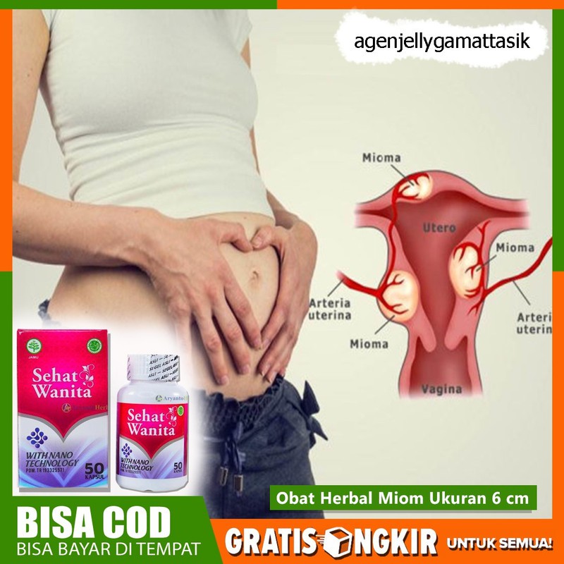 Obat Miom Ukuran 6Cm - Obat Miom Cod - Obat Miom Parah - Sehat Wanita 50 Kapsul